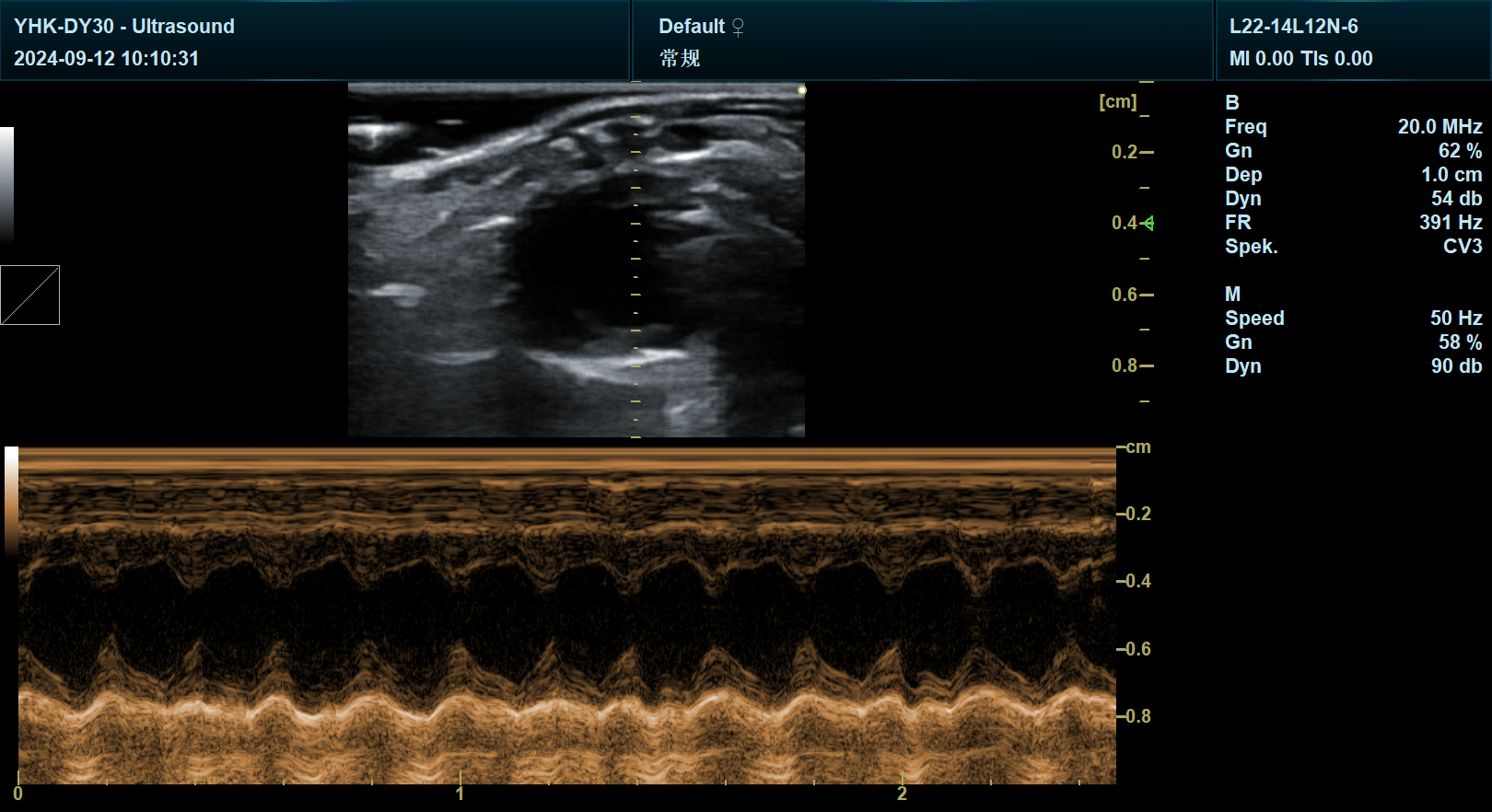 宜慧康超声设备扫查小鼠的M型超声波 宜慧康超声设备扫查小鼠的M型超声波