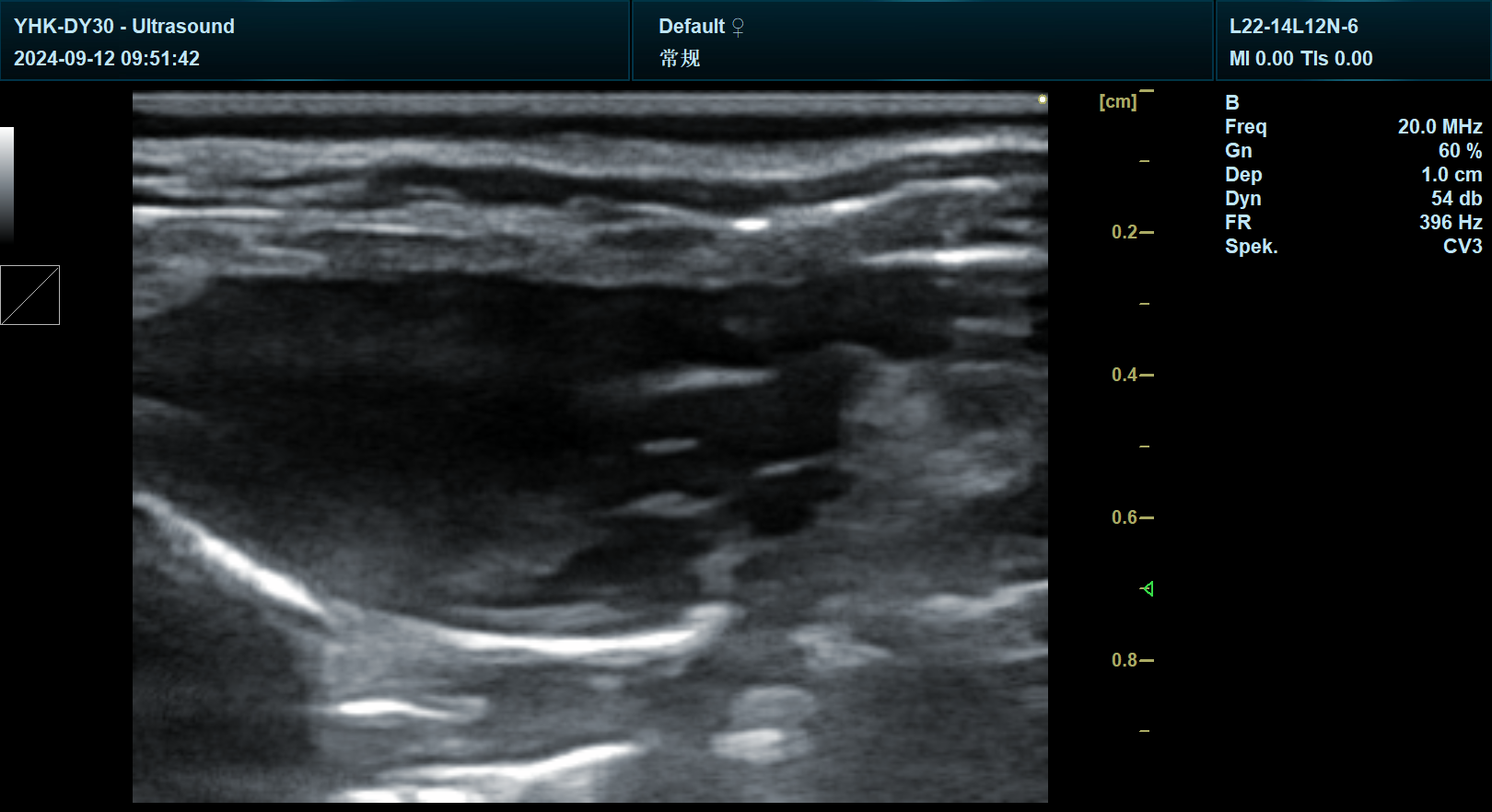 宜慧康彩超扫描小鼠左室长轴图片