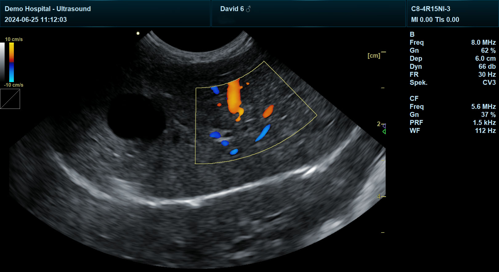 宜慧康彩超扫描犬肝脏血流影像图